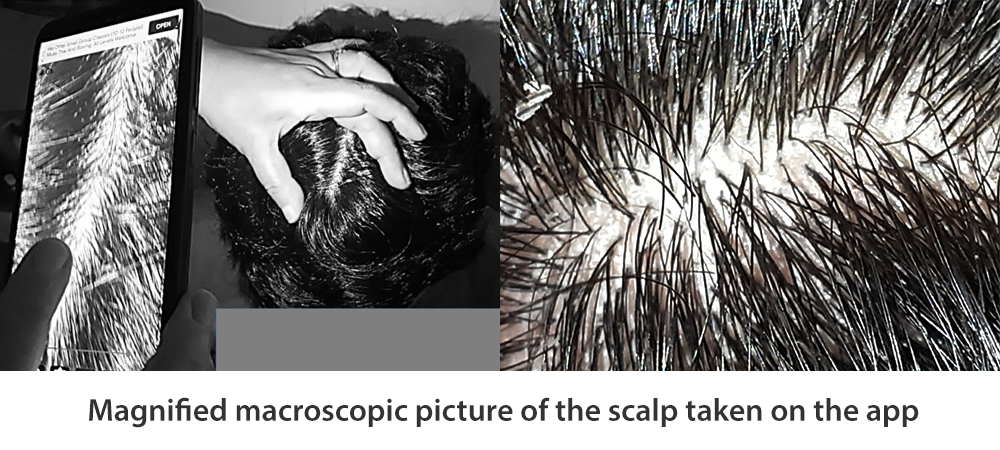 https://hairrevive.com/wp-content/uploads/2020/06/MAGNIFIED-MACRO-PICTURE-SCALP
